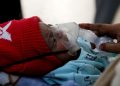 Kasus Mycoplasma Pneumonia Telah Ditemukan di Jakarta